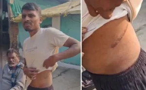 सोशल मीडिया पर फंसाकर बेचते थे किडनी, 'डॉ. कृष्णा' गिरफ्तार